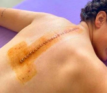 dolor postquirurgico