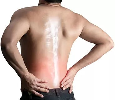 sindrome lumbar